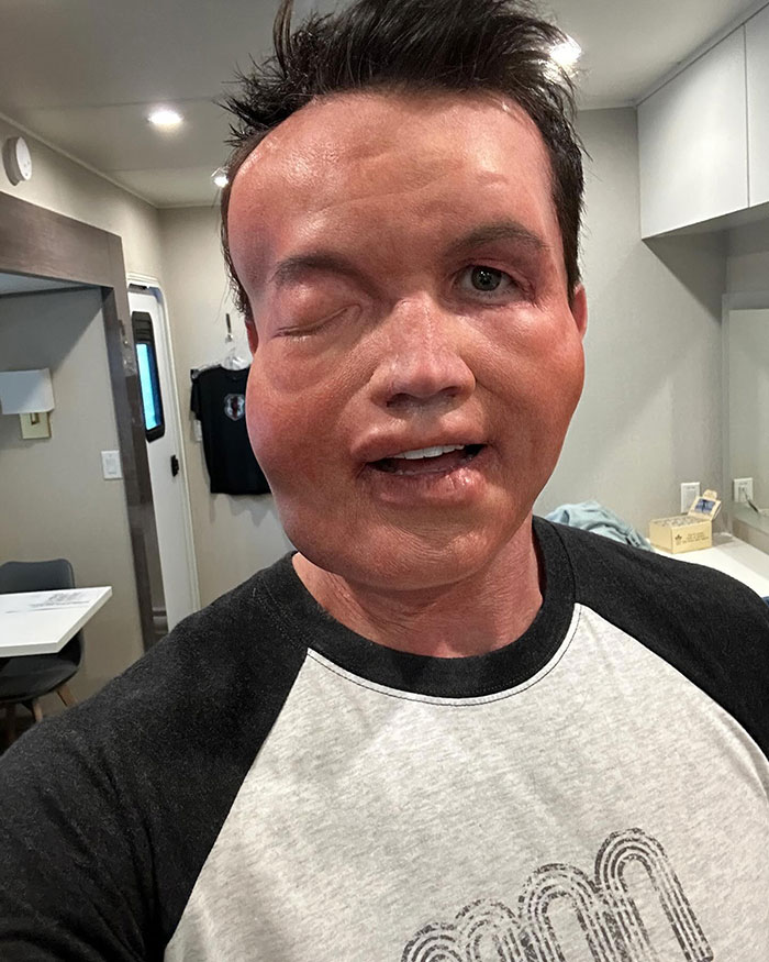 Rob McElhenney&rsquo;s Fans Disturbed As Actor Shares New Year&rsquo;s Eve Photo Of His &ldquo;Swollen&rdquo; Face