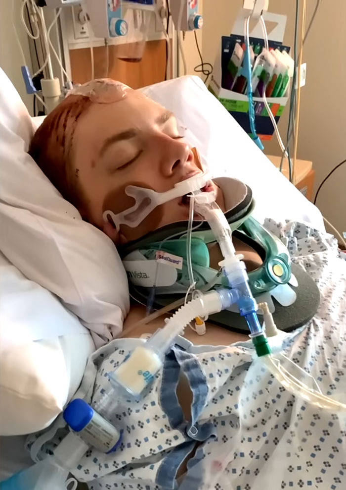 Man Who Underwent Skull Removal Surgeries To &ldquo;Wash&rdquo; His Brain Gets Denied Disability Benefits