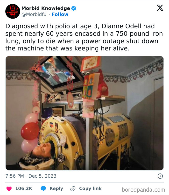 Woman encased in a 750-pound iron lung machine, one of the most terrifying and disturbing images shared online.