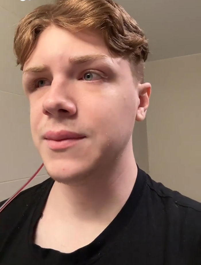 Man Who Underwent Skull Removal Surgeries To &ldquo;Wash&rdquo; His Brain Gets Denied Disability Benefits