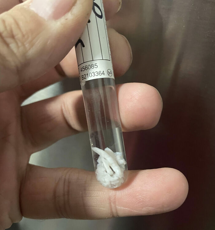 This Is $4200 Worth Of Cartilage Taken Out Of My Dog's Shoulder