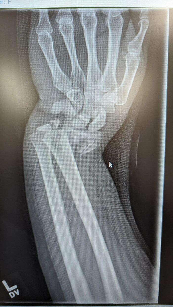 Five Days Into The Year And I'm Already Done