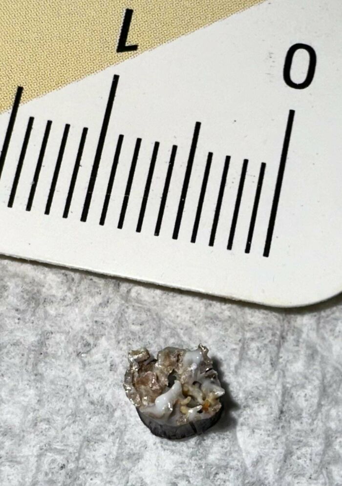 4-5mm Wide, 3mm High. Tubular In Shape, Visibly Hollow On One Side, With Pokey White/ Yellow/Brown Protrusions Obscuring The Hollow End On The Opposite Side. Hard To The Touch. Gray-Ish/Taupe On The Outside. Found In Mouth During Pancake And Yop Yogurt Drink Meal