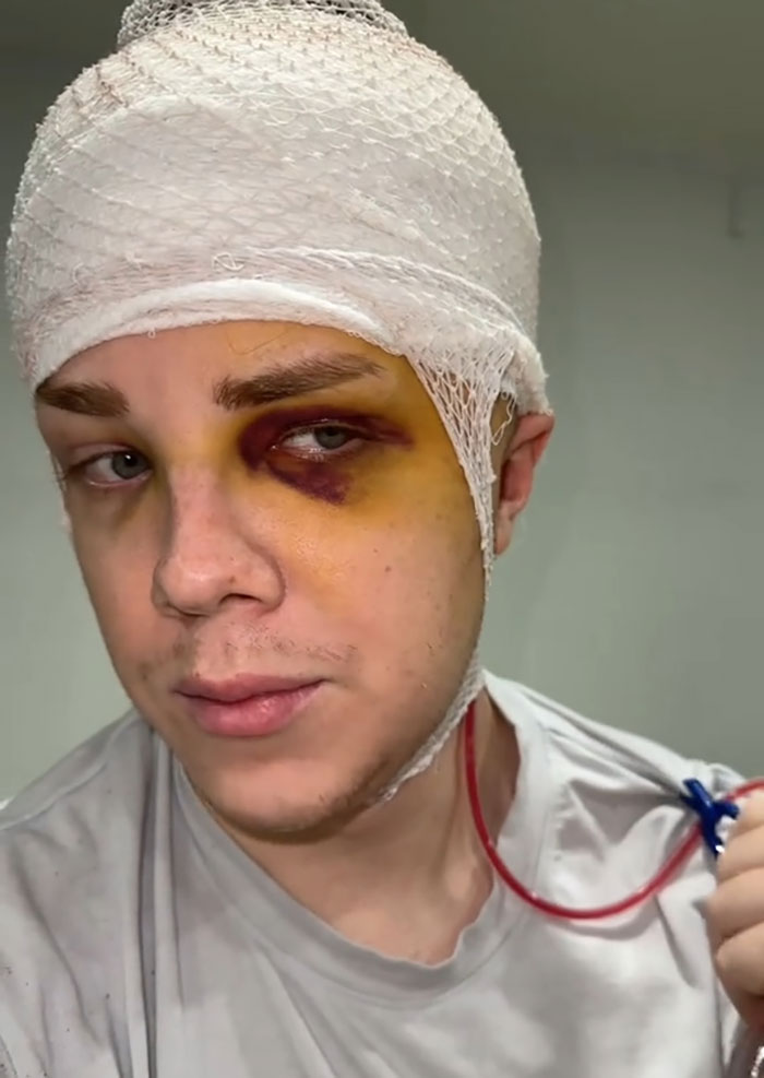 Man Who Underwent Skull Removal Surgeries To &ldquo;Wash&rdquo; His Brain Gets Denied Disability Benefits