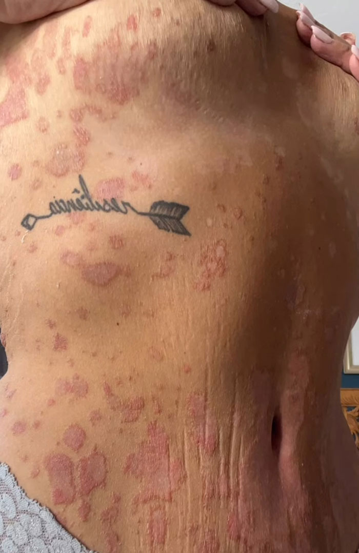 Weight Loss Influencer Mila De Jesus, Who Went Viral For Her Transformation, Passes Away At 35