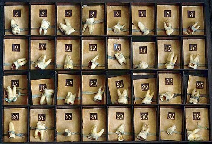 A Collection Of Teeth Extracted By Peter The Great (1672-1725) Who, Despite Having No Formal Medical Training, Fancied Himself To Be A Terrific Amateur Surgeon