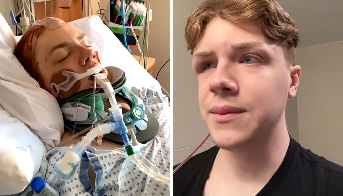 Man Who Underwent Skull Removal Surgeries To “Wash” His Brain Gets Denied Disability Benefits