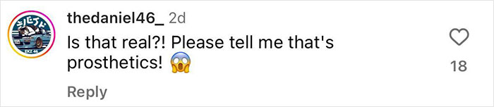 Rob McElhenney&rsquo;s Fans Disturbed As Actor Shares New Year&rsquo;s Eve Photo Of His &ldquo;Swollen&rdquo; Face