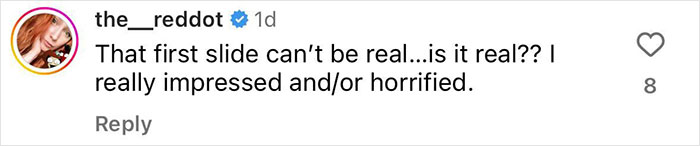 Rob McElhenney&rsquo;s Fans Disturbed As Actor Shares New Year&rsquo;s Eve Photo Of His &ldquo;Swollen&rdquo; Face