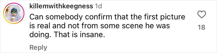Rob McElhenney&rsquo;s Fans Disturbed As Actor Shares New Year&rsquo;s Eve Photo Of His &ldquo;Swollen&rdquo; Face