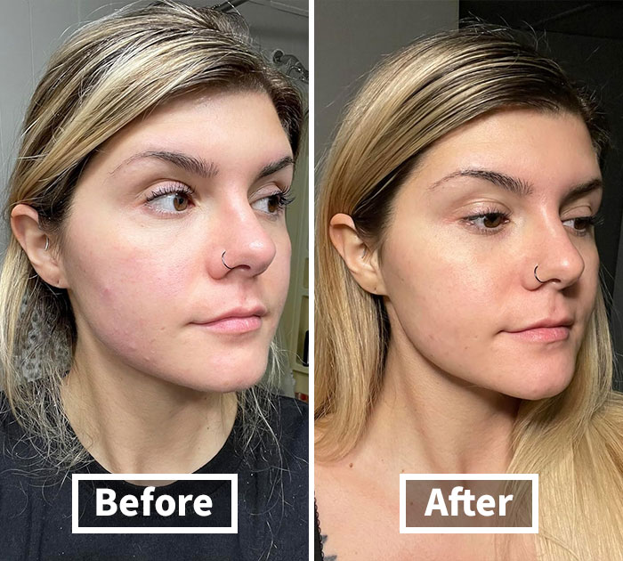 Meet Snail Mail You'll Actually Love! With Cosrx Snail Mucin 96% Power Repairing Essence, Upgrade Your Skincare Routine So You Can Slide Into The Day With Silky Smooth Confidence