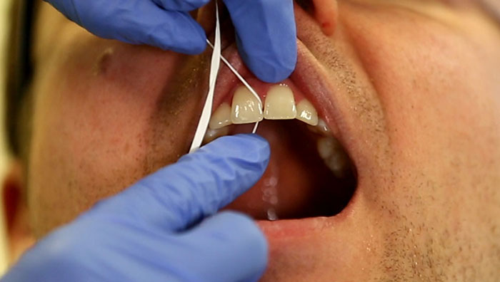 31 Common Hygiene Mistakes Everyone Should Be Aware Of For The Greater Good Of The Population