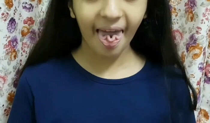 “Cheetahs Are Extremely Inbred”: 50 Interesting Genetics Facts You May Have Missed At School