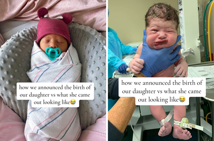 People-Share-Ugly-Newborn-Photos
