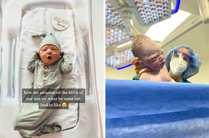 People-Share-Ugly-Newborn-Photos