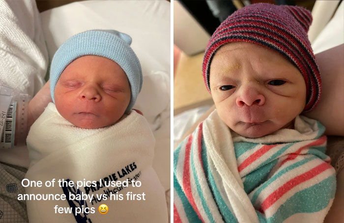People-Share-Ugly-Newborn-Photos