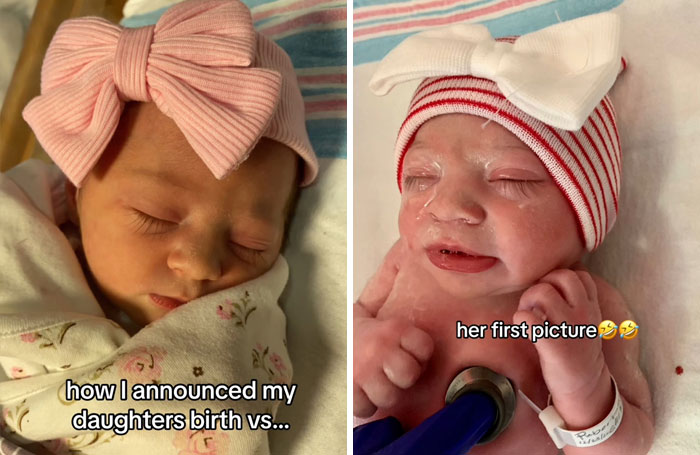 People-Share-Ugly-Newborn-Photos
