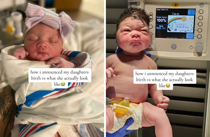 People-Share-Ugly-Newborn-Photos