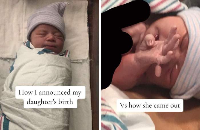 People-Share-Ugly-Newborn-Photos