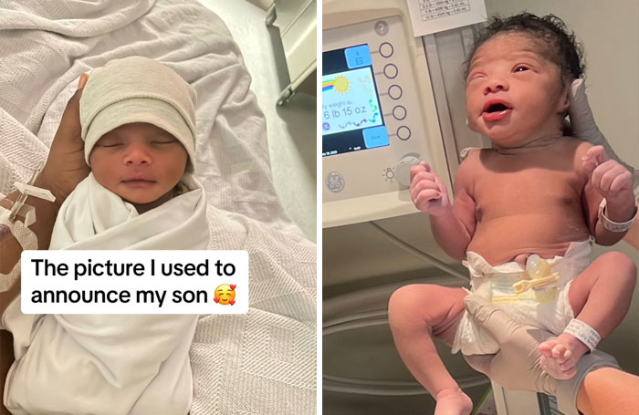 People-Share-Ugly-Newborn-Photos