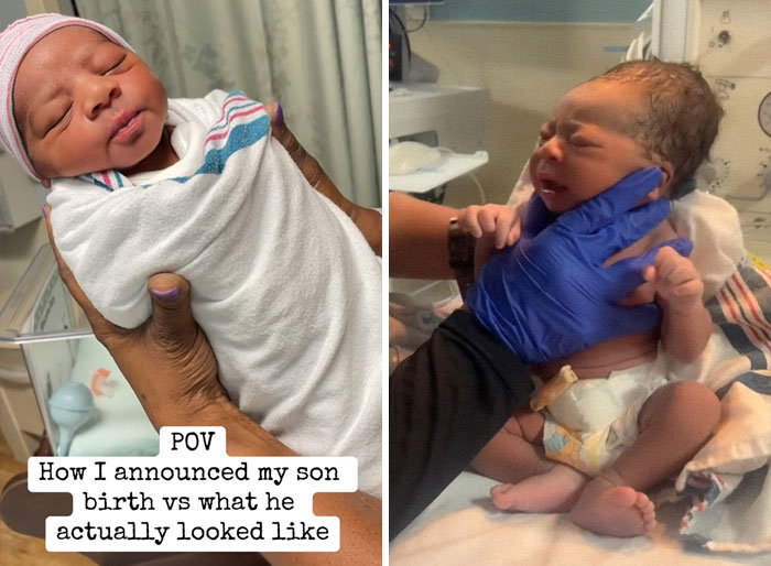 People-Share-Ugly-Newborn-Photos