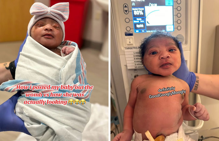 People-Share-Ugly-Newborn-Photos
