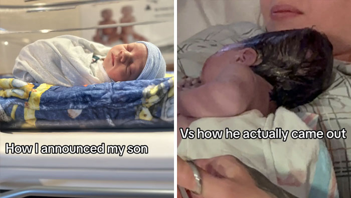 People-Share-Ugly-Newborn-Photos