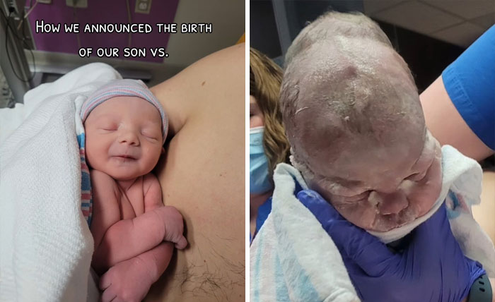 People-Share-Ugly-Newborn-Photos