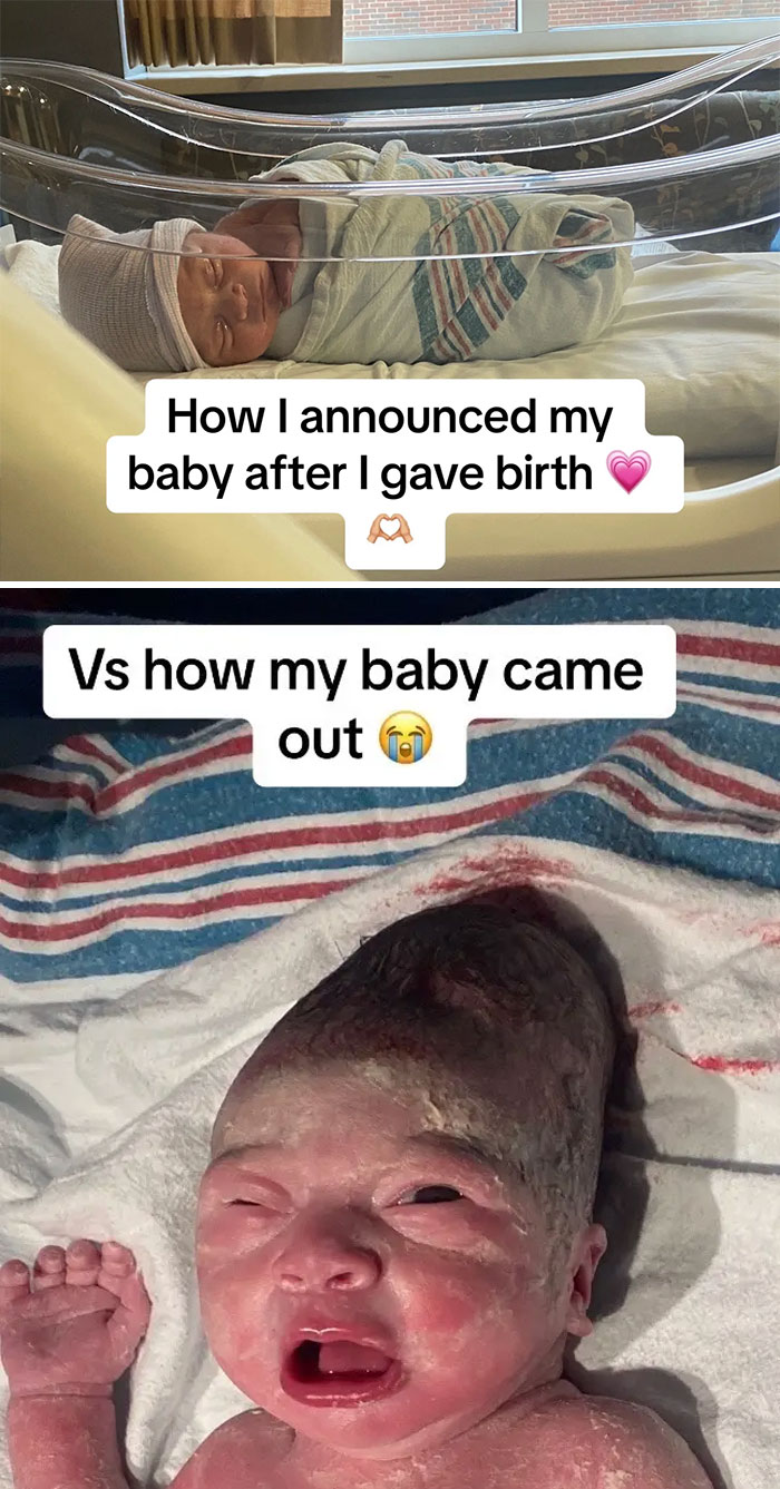 People-Share-Ugly-Newborn-Photos