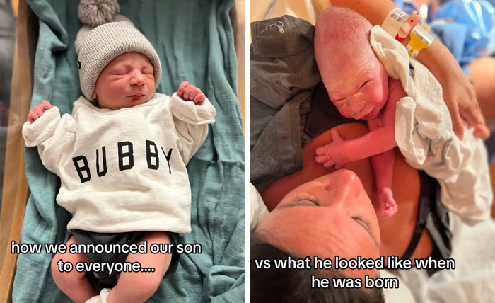 People-Share-Ugly-Newborn-Photos