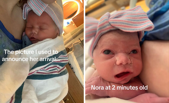People-Share-Ugly-Newborn-Photos
