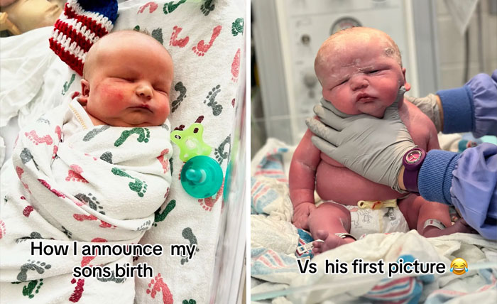 People-Share-Ugly-Newborn-Photos