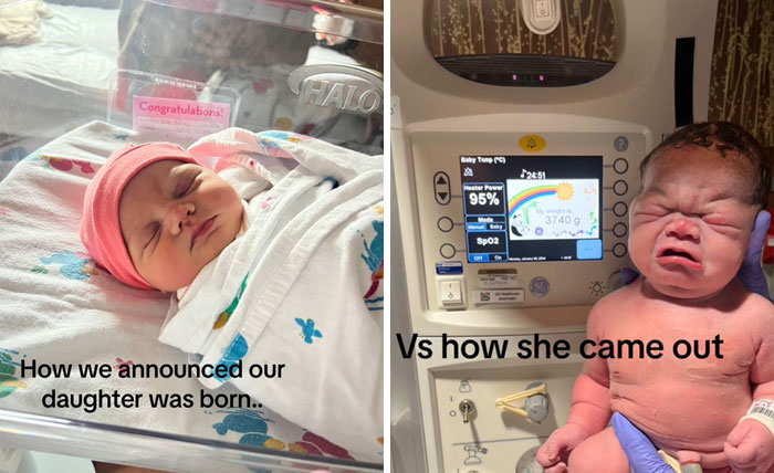 People-Share-Ugly-Newborn-Photos