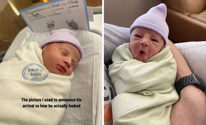 People-Share-Ugly-Newborn-Photos