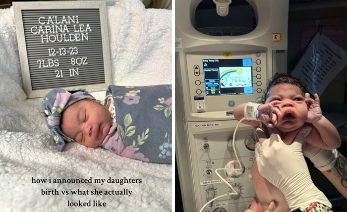 People-Share-Ugly-Newborn-Photos