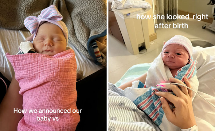 People-Share-Ugly-Newborn-Photos