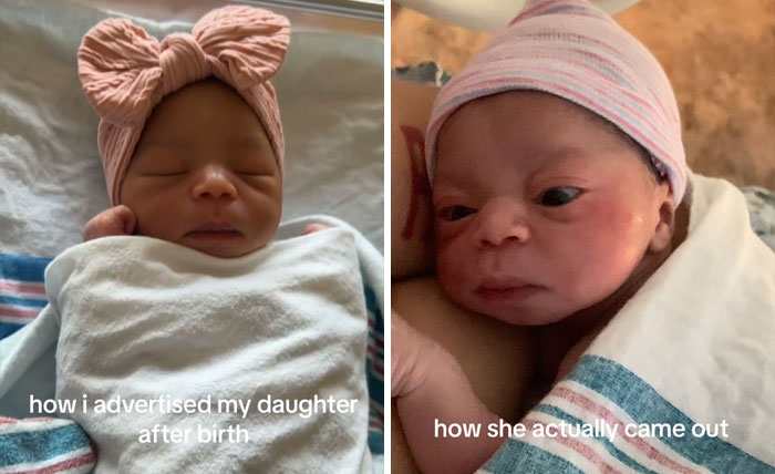 People-Share-Ugly-Newborn-Photos