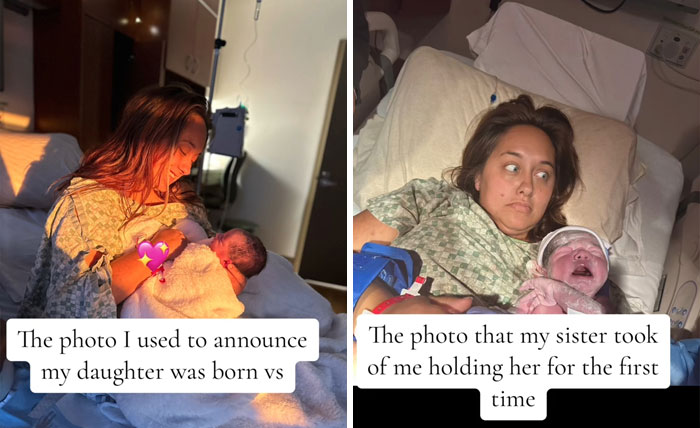 People-Share-Ugly-Newborn-Photos