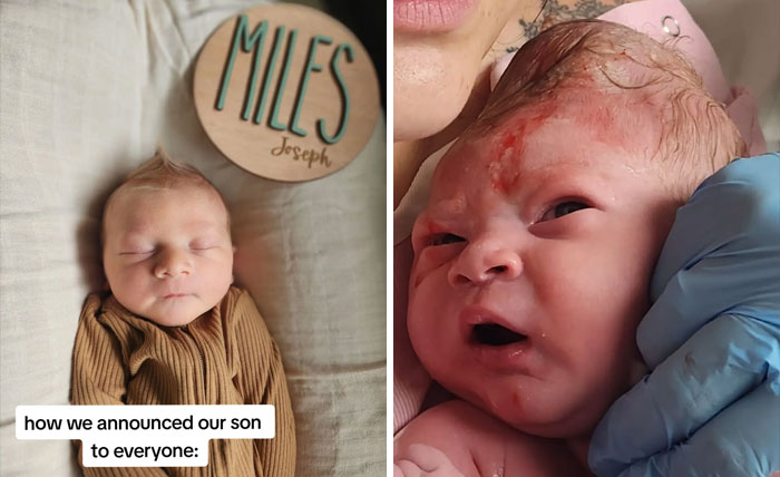 People-Share-Ugly-Newborn-Photos