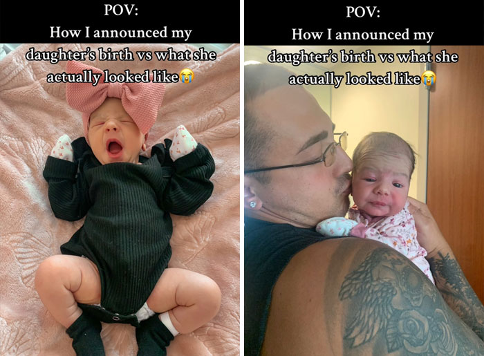 People-Share-Ugly-Newborn-Photos