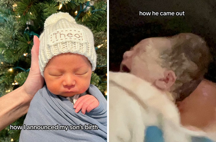 People-Share-Ugly-Newborn-Photos