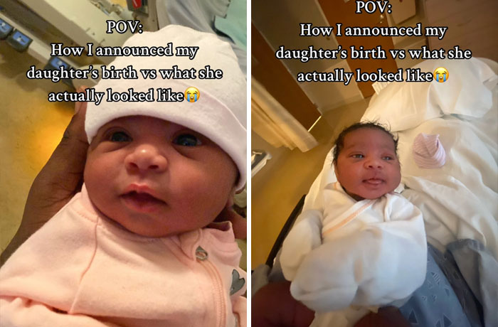 People-Share-Ugly-Newborn-Photos