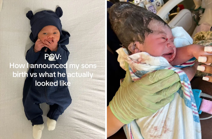 People-Share-Ugly-Newborn-Photos