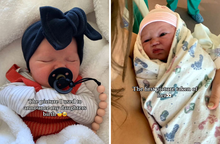 People-Share-Ugly-Newborn-Photos