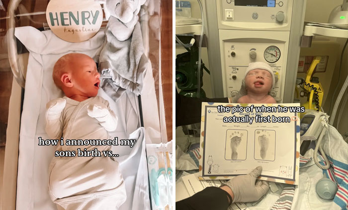 People-Share-Ugly-Newborn-Photos