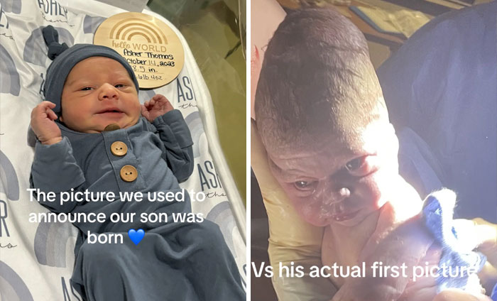 People-Share-Ugly-Newborn-Photos