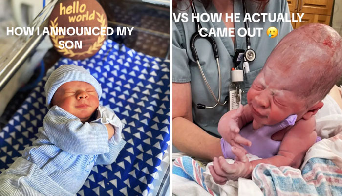 People-Share-Ugly-Newborn-Photos