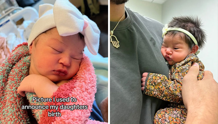 People-Share-Ugly-Newborn-Photos