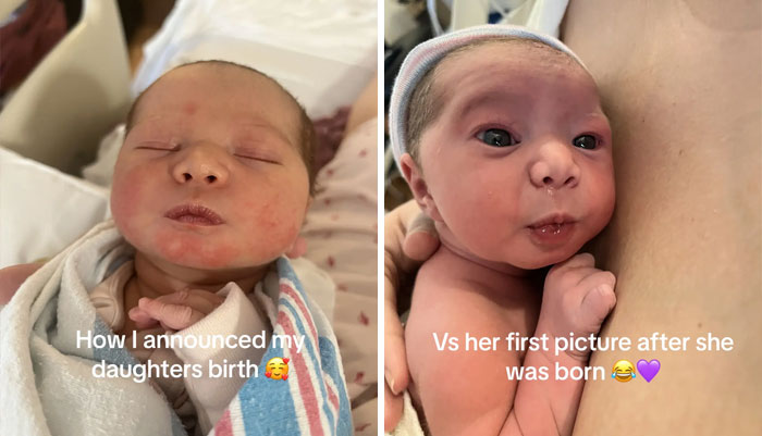People-Share-Ugly-Newborn-Photos