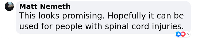 “That Is The Goal”: Elon Musk’s Neuralink Is Implanted In First-Ever Human “That Is The Goal”: Elon Musk’s Neuralink Is Implanted In First-Ever Human